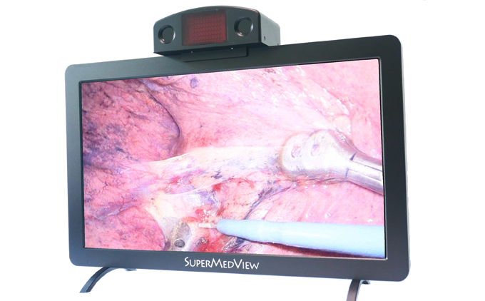 裸眼3D显示系统   适用于所有3D腹腔镜系统